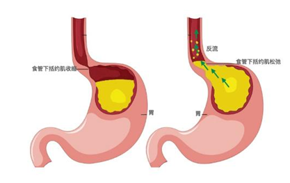 好消化有营养的食物有哪些(养胃又容易消化的食物)