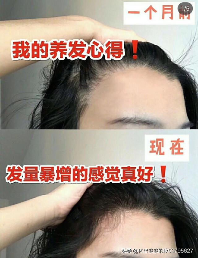 什么洗发水防脱生发 生发洗发水哪款好？哪款防脱发的洗发水比较有效，头发掉的厉害？