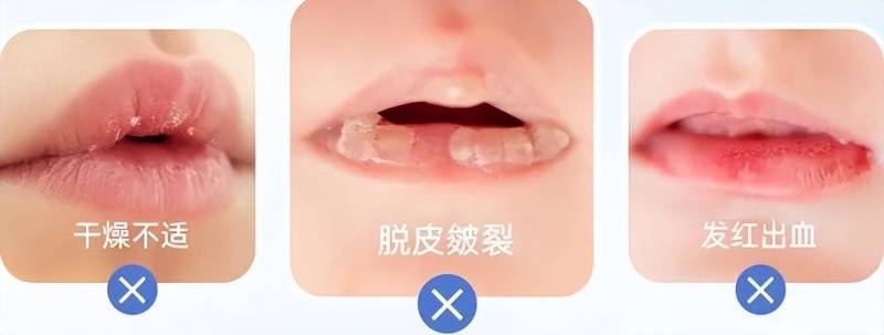 澳洲唇膏什么牌子好？推荐几款温和好用的澳洲唇膏？